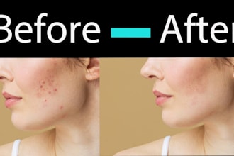 do dust, spot, pimple, dark circles  remove from image