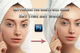 remove anywrinkles, blemishes, spots, pimples