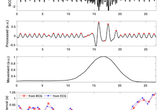 analyze and preprocess biomedical signals with dsp ml dl