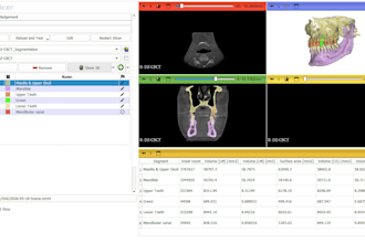 dicom ct mri image segmentation volumetric quantitative assessment in 3d slicer