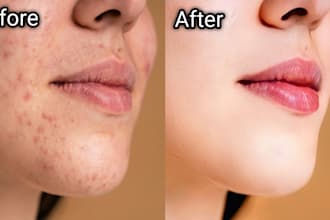 fast pimple removal and skin retouching