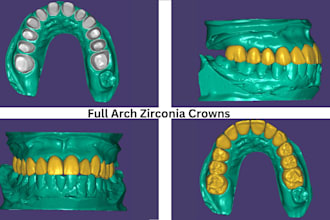 create high quality dental restorations using exocad