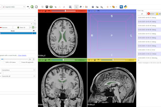 segment anatomical structures from nifti dicom images using 3d slicer