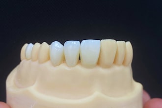 design accurate dental crowns, bridges, veneers , using exocad