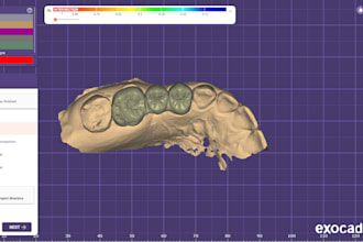 design crown, bridges, onlay and endocrown  with exocad software