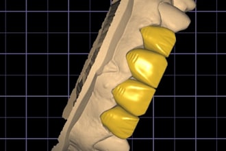 design dental crowns, bridges, and veneers for you