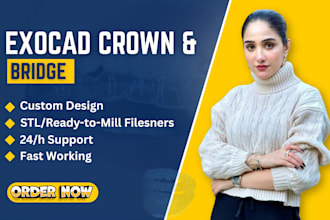 design crowns and bridges using exocad