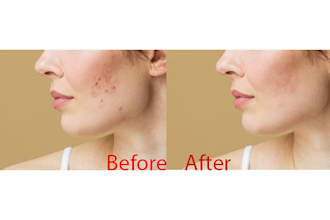 emove wrinkles,dark circles,unwanted spots