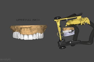 design your dental bridges, crowns or any type of restorations