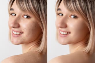 retouch your skin naturally and remove pimples like a pro