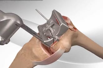 do 3d medical animation video blender pharmaceutical anatomy surgical explainers