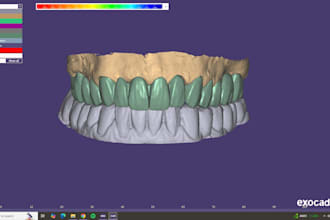 make the best exocad designs