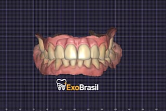 deliver aesthetic and functional dental designs in exocad