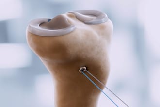 3d animated medical video, biology explainer video surgery and dental animation