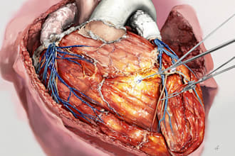draw a realistic anatomical surgery medical illustration
