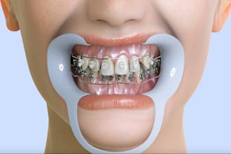 3d medical animation, surgery video, dental care animation, 3d medical device