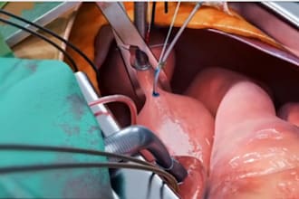 3d surgical animation medical 3d animation surgery animation procedure anatomy