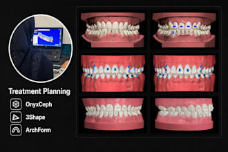 do predictable clear aligners treatment planning