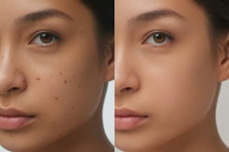 do professionally remove acne and skin blemishes from your photos