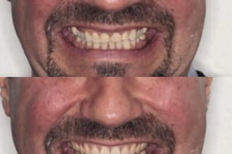 create digital smile design for you