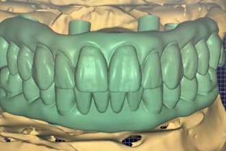 design high quality dental prosthetics using exocad cad cam