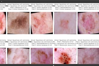 build a CNN model to detect skin diseases from images