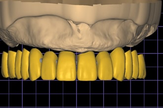 professionally design dental cad cam restorations, models, and surgical guides