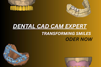 custom dental cad cam libraries and optimize your digital workflow