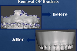 do high quality dental 3d file meshing with meshmixer