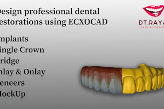 create precise and professional dental designs using exocad