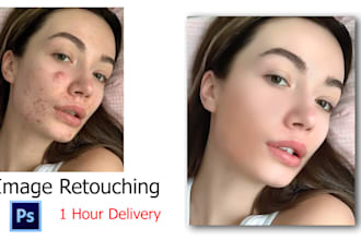 do face cleanup and remove blemishes from image