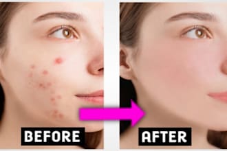 remove pimples, blemishes and photo retouching from photos