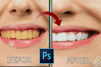 edit your teeth, align, whiten teeth, and remove braces