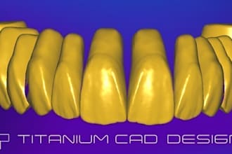 titanium full library exocad I 11 pieces