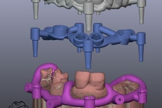 design your surgical guide  for implant surgery