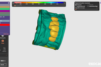 create accurate dental prosthesis designs using exocad