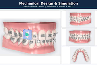 dental and medical product design and simulation