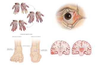 create custom medical illustrations in photoshop or illustrator, no ai