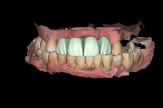 design crown and bridge using exocad