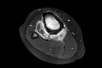 provide mri and ct brain and spine reports or second opinion by radiologist