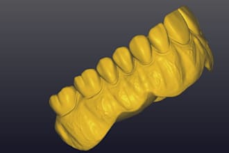 create  designs digital complete denture using exocad