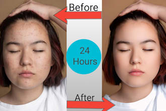 do high end portrait skin retouching and blemish removal in 24 hours