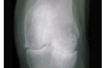 do medical imaging ai for disease classification by grad cam mri xray radiology