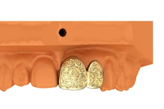 professional custom grillz cad modeling and rendering
