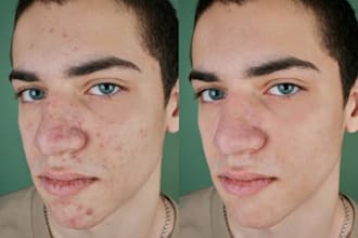 fix your portraits, remove blemishes, marks and imperfections