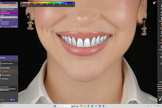 design top quality dental veneers, crowns and bridges