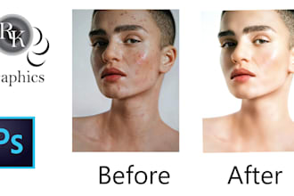 professionally remove acne and pimples from your photos