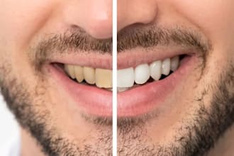 professionally whiten teeth and make a natural bright smile