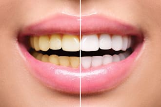 make your teeth whiter and your smile look natural