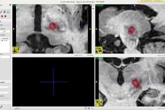 manually segment, annotate, label, and add bounding boxes to your medical images